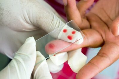 Diagnosis of pain in the joints of the fingers