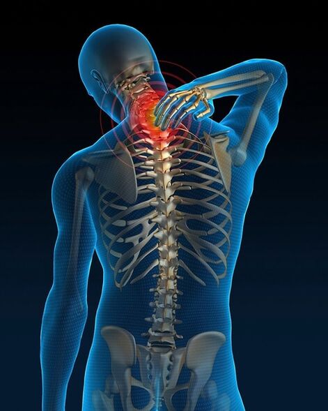 At the initial stage of treatment of cervical osteochondrosis, neck pain increases